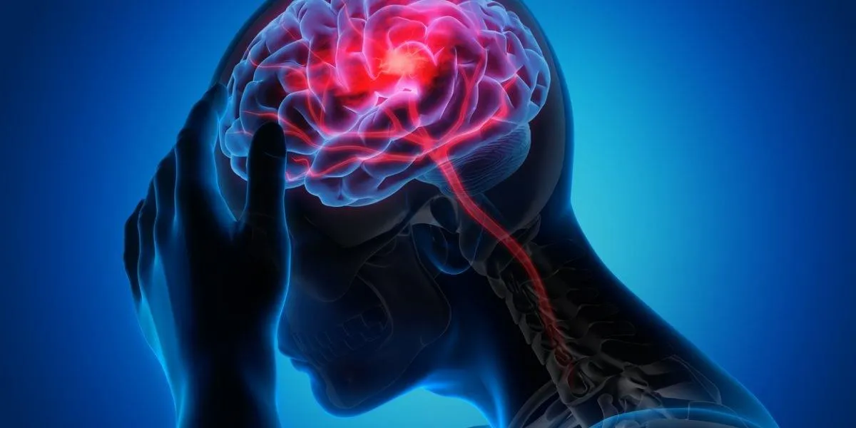 طول عمر پس از سکته مغزی