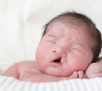 گفتاردرمانی لب شکری