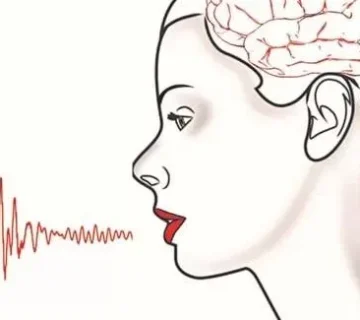 اختلال تکلم در اثر ضایعه مغزی