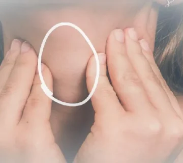 تمرینات گفتار درمانی برای ندول‌ حنجره