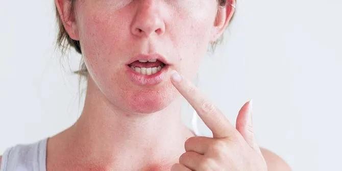 درمان خانگی لکنت زبان