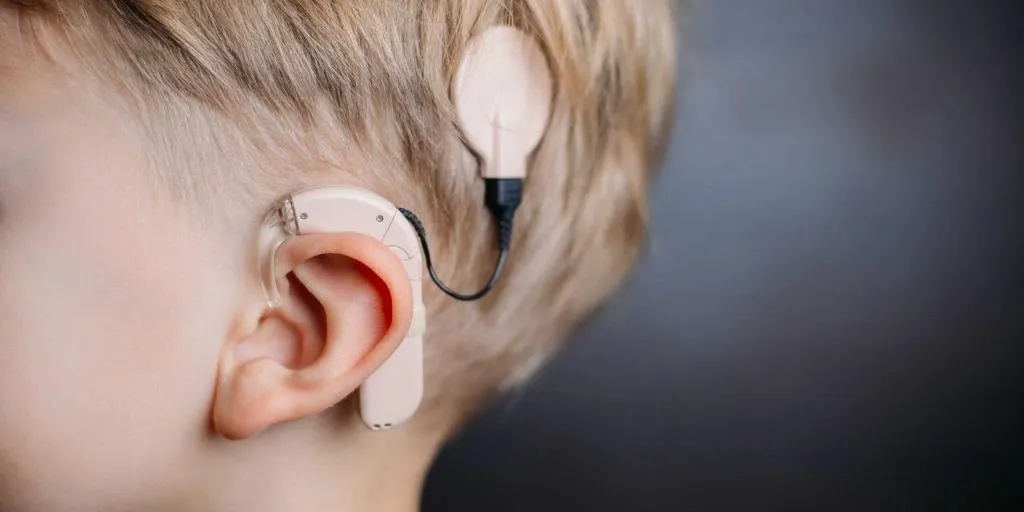 گفتار درمانی بعد از کاشت حلزون