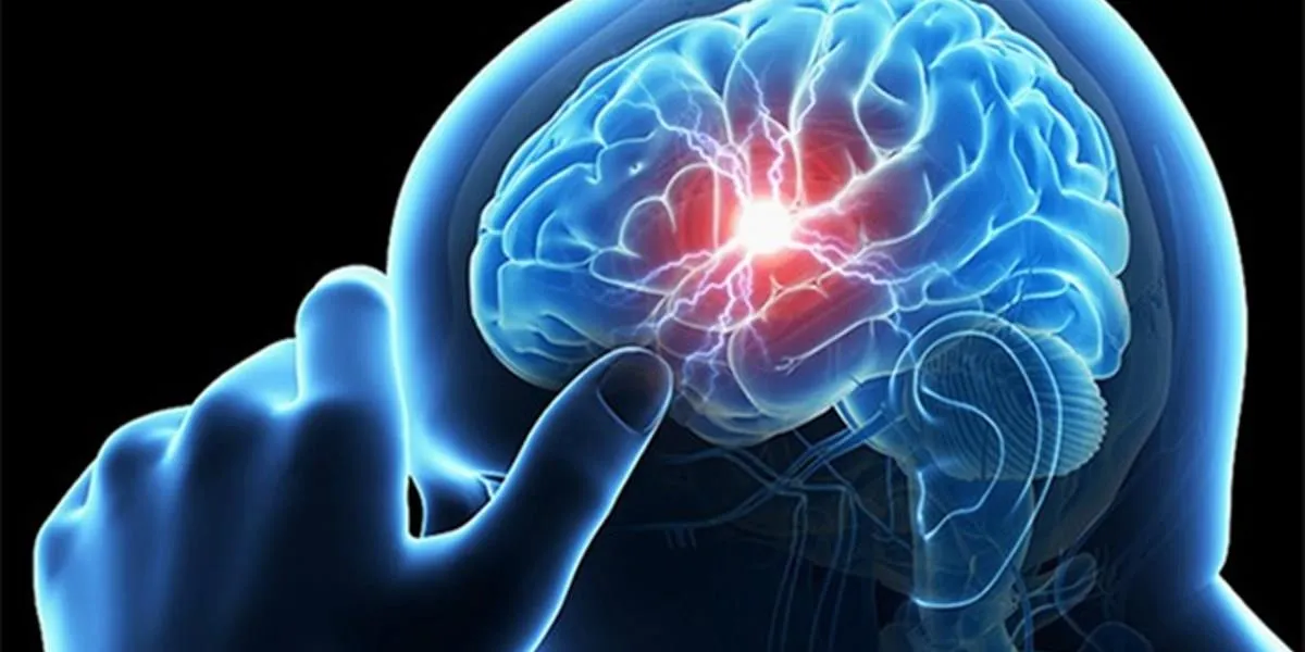 گفتار درمانی پس از سکته مغزی