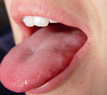 علت سنگینی زبان چیست ؟